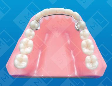Banded 4x4 Retainer U/L