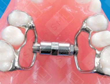 Super-Screw