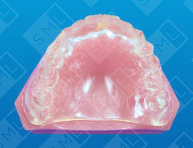 CT Scan Appliance for the Fully Edentulous Patient
image 1