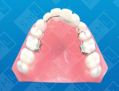 Fixed/Removable Banded Temp Anterior Bridge