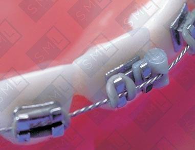 Fixed Attachments image 2