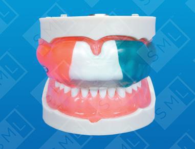 Intact® Martial Arts Mouthguard