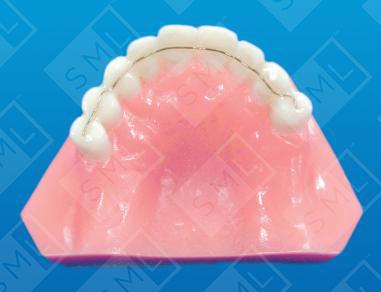 Wire/Composite Splint