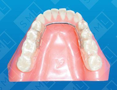 MORA/Gelb with Anatomical Occlusion L