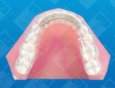 mandibular bruxism splint