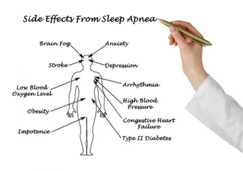 Sleep Apnea Dental Appliances